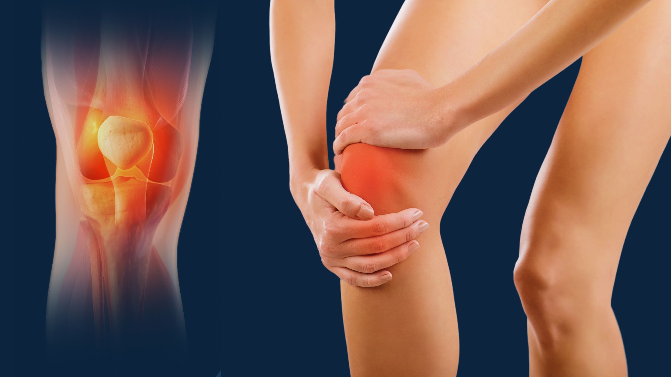 What is bursitis?