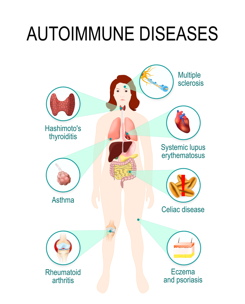 What are autoimmune diseases?