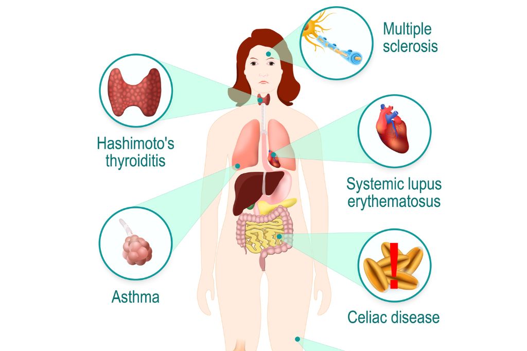 What are Autoimmune Diseases?