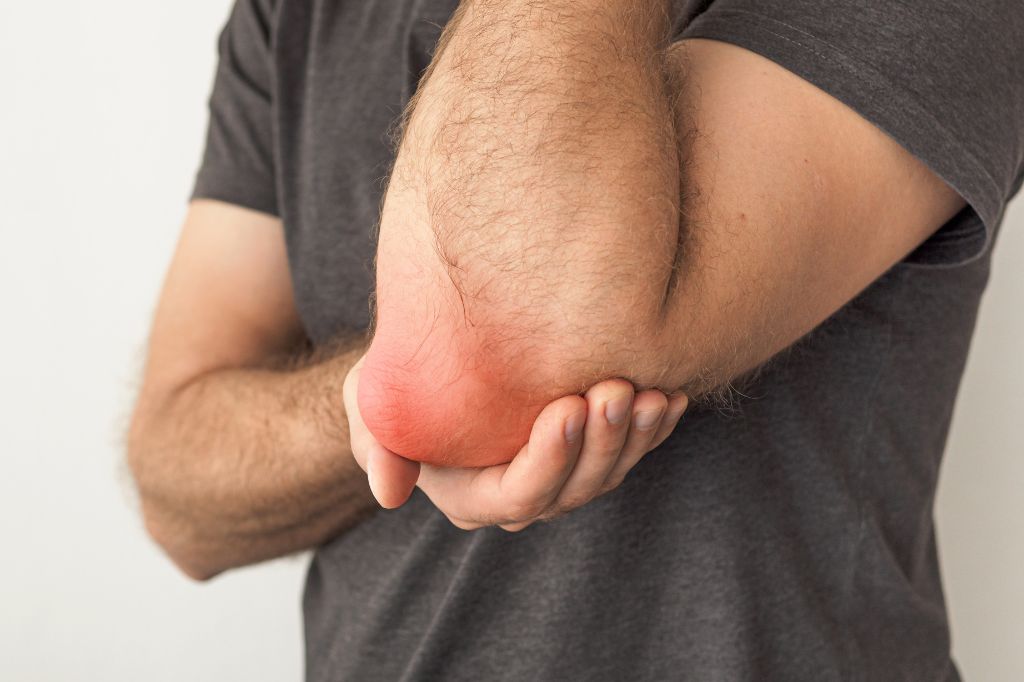 What is Bursitis?