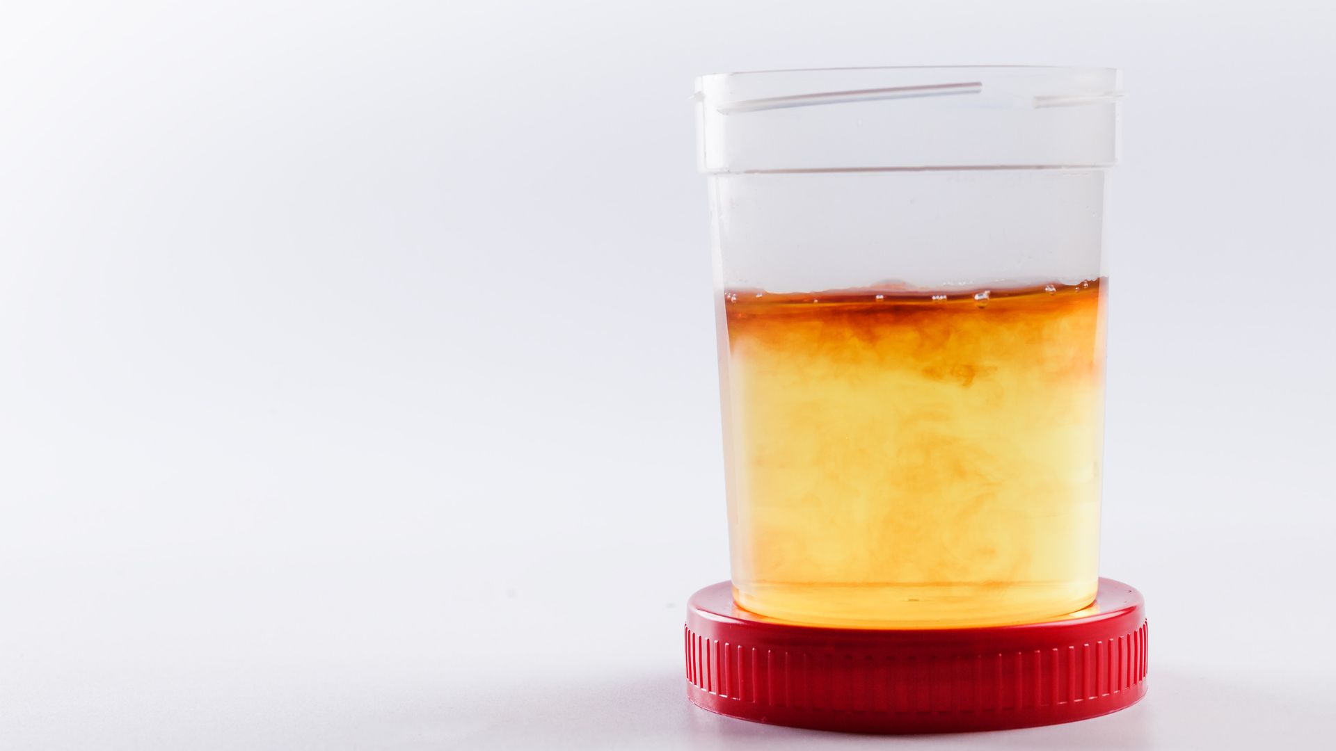 Why Is My Urine Dark? 7 Causes of Dark Urine