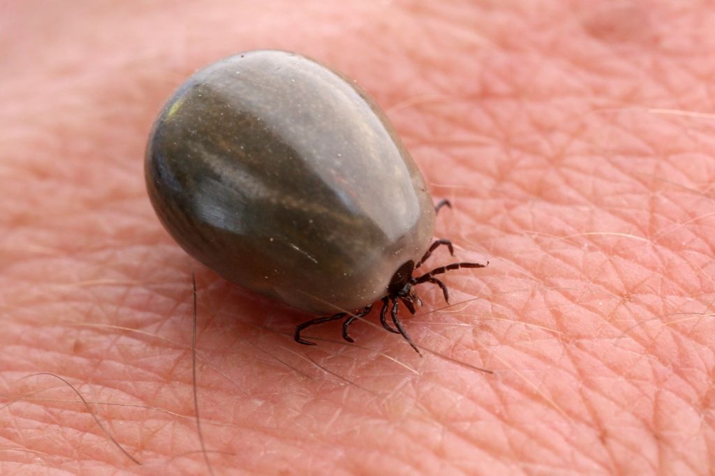 Early Symptoms of Lyme Disease