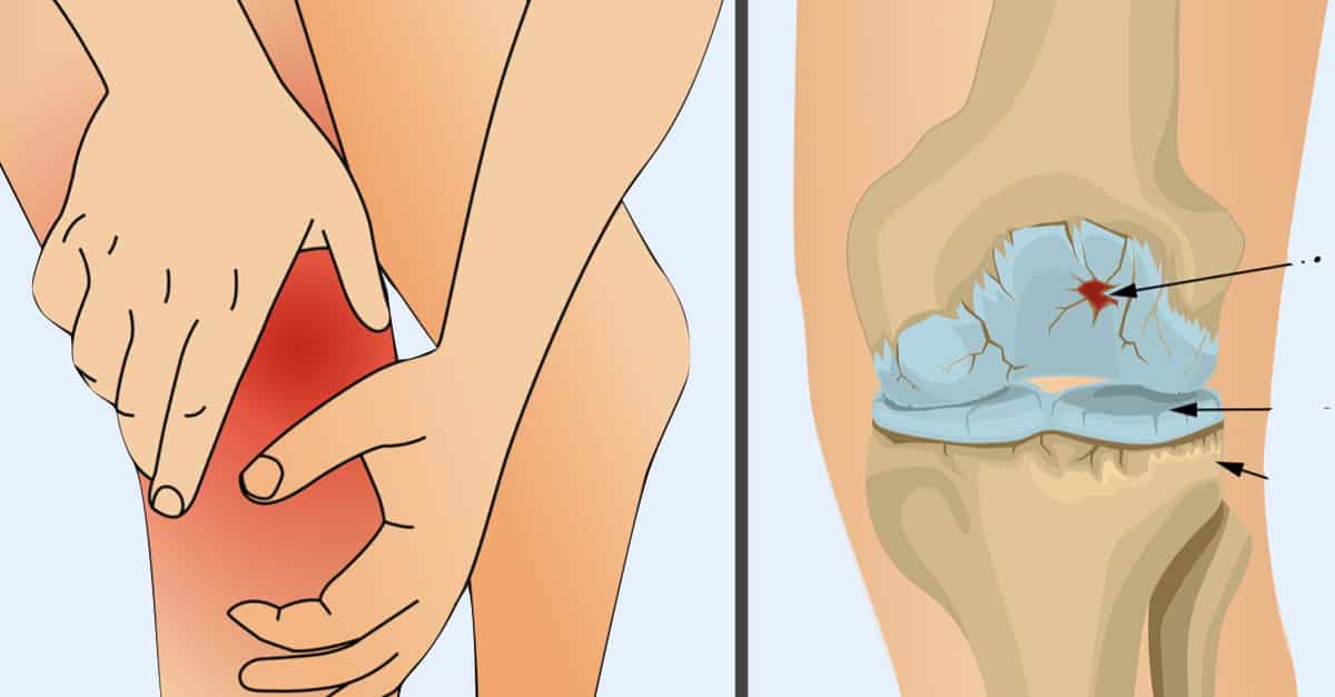 10 Foods You Need to Eat to Get Rid of Joint Pain