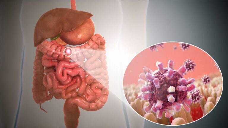 Gut Health