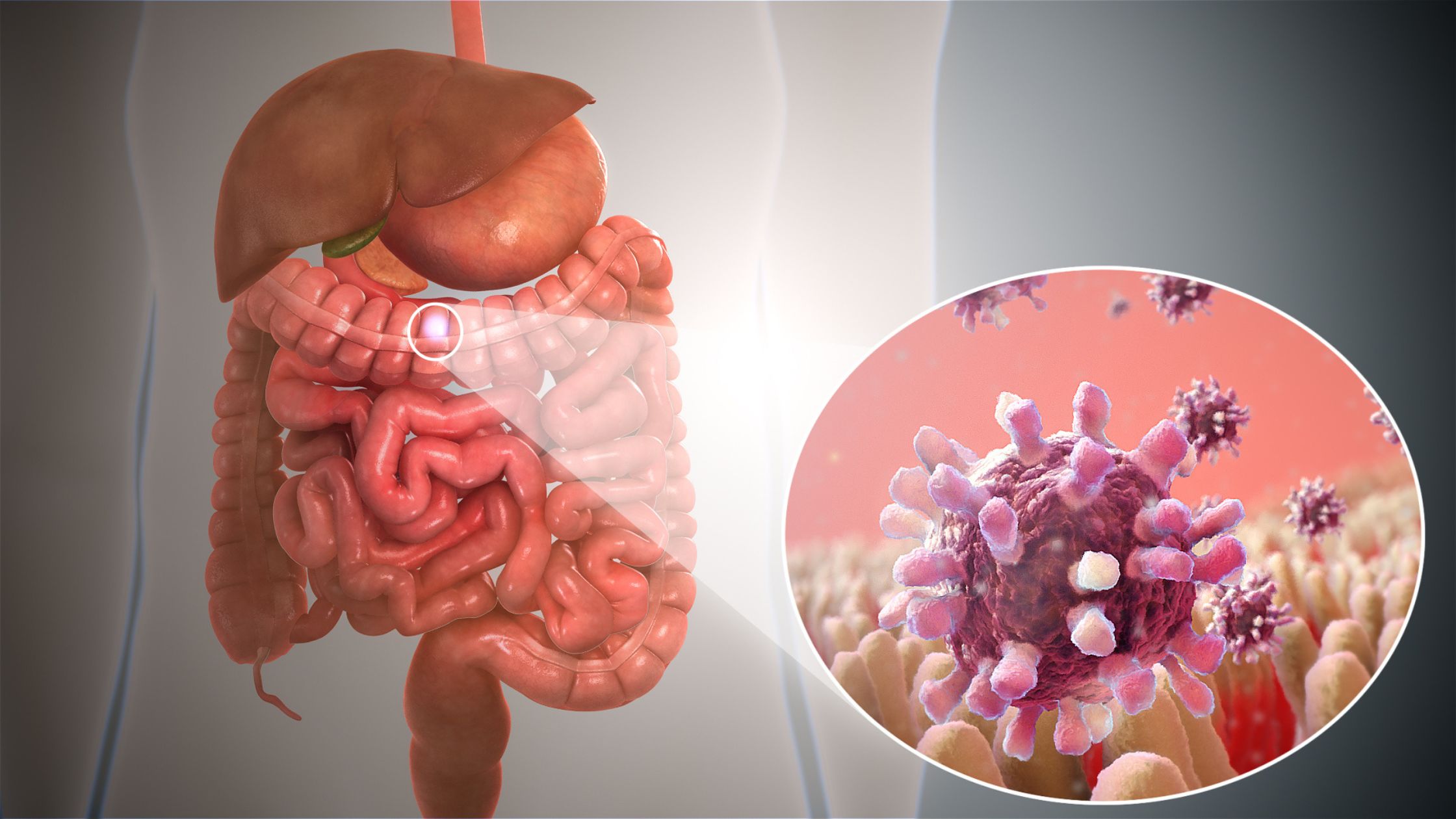 Gut Health: What it is and Why You Should Care