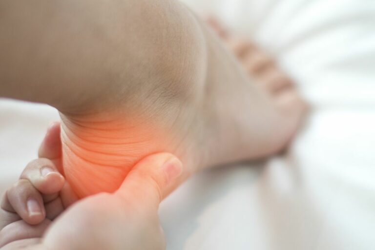 Heel Pain? 6 Home Remedies for Your Plantar Fasciitis