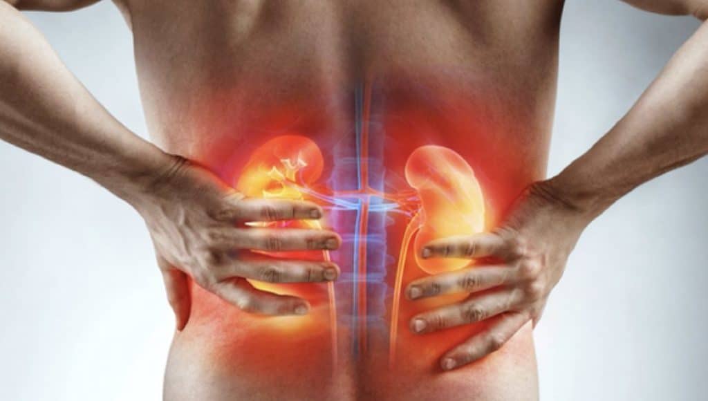 How to Differentiate Kidney Pain from Back Pain