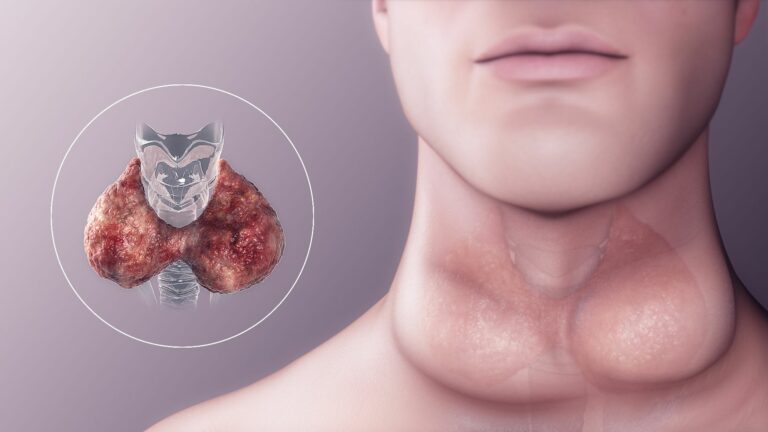 Signs of Thyroid Problems