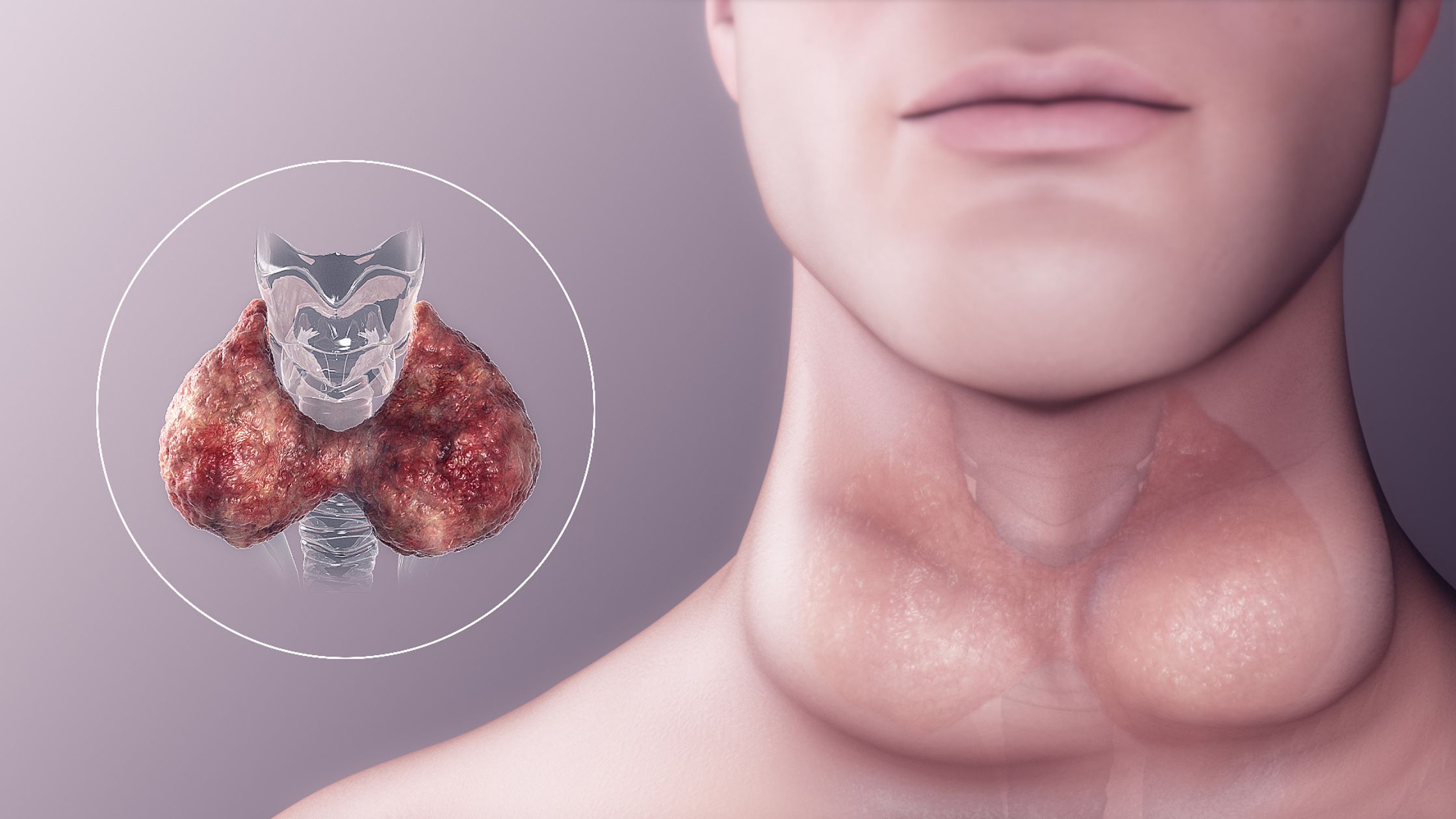 15 Signs of Thyroid Problems