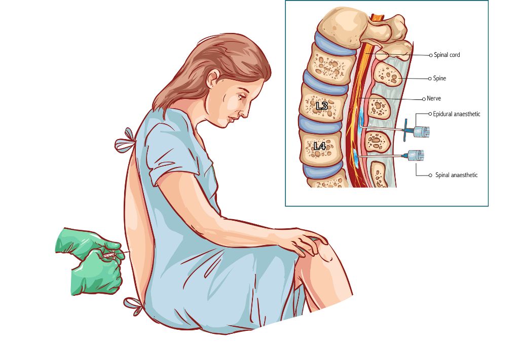 Things That Happen to Your Body When You Worry Too Much