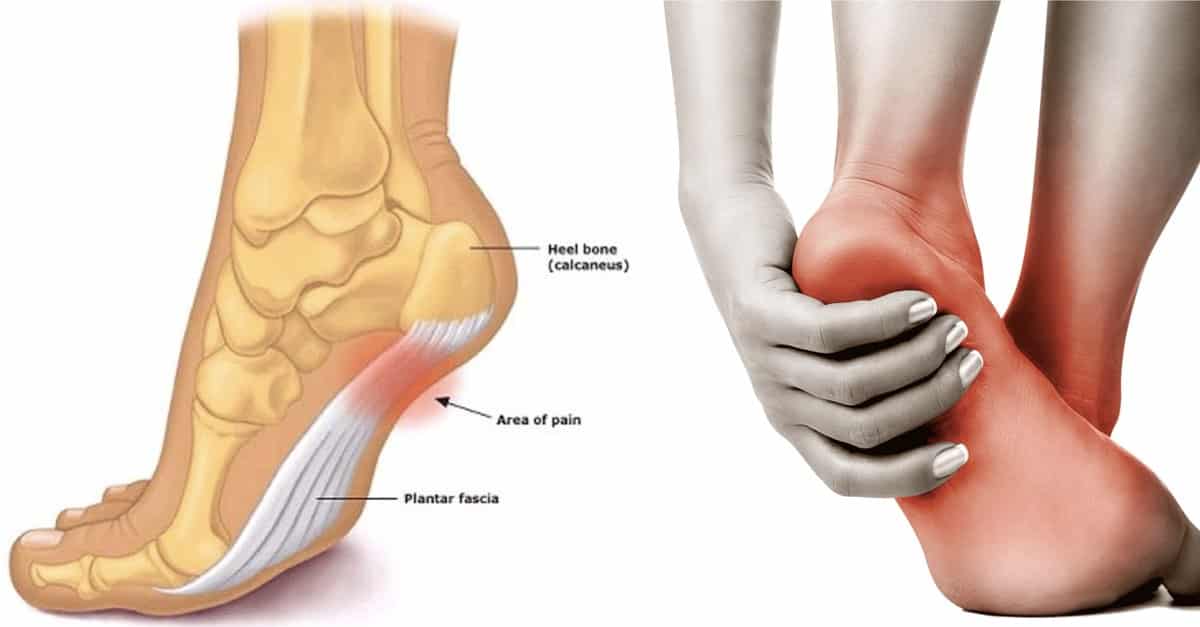 6 Types of Foot Pain You Should Never, Ever Ignore