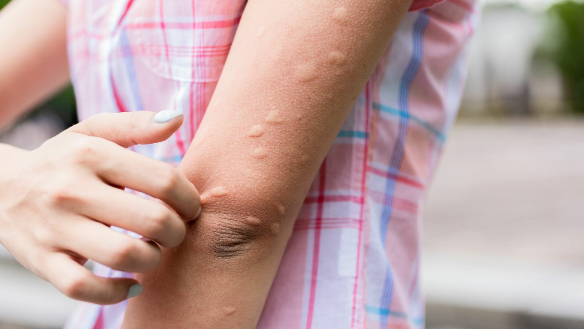 Prevent Mosquito Bites
