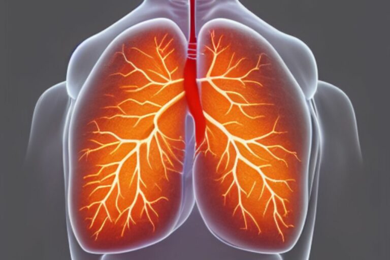 What Is Lung Cancer?