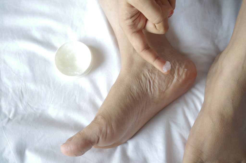 Home Remedies For Cracked Heels And Dry Feet