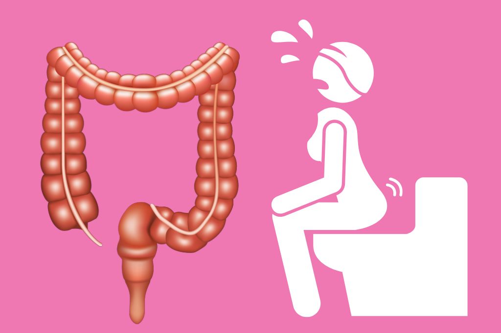 Natural Home Remedies For Constipation
