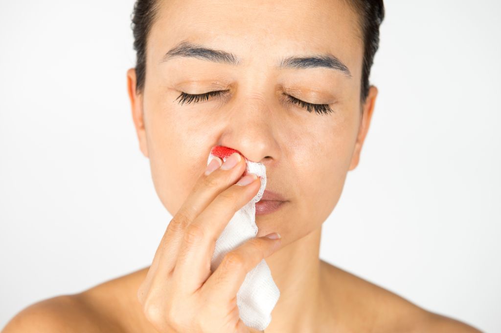 How to Stop a Nosebleed at Home