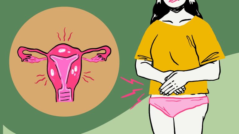 PCOS Symptoms: Signs You May Have This Hormone Disorder
