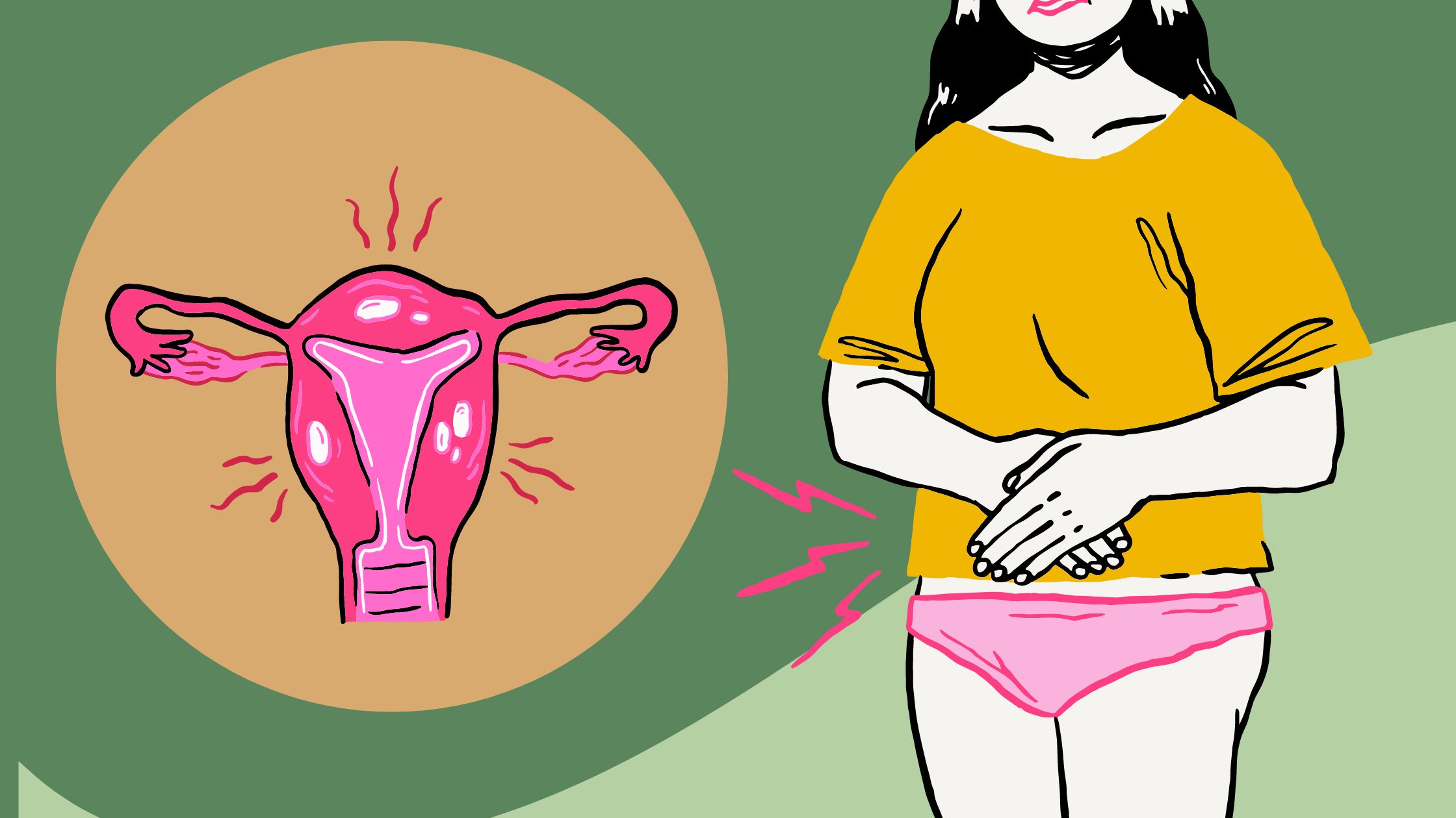 PCOS Symptoms: Signs You May Have This Hormone Disorder