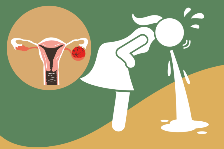 Signs of ovarian cysts