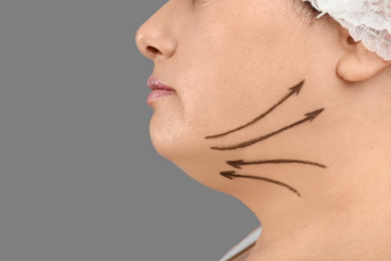 How to Lose Face Fat