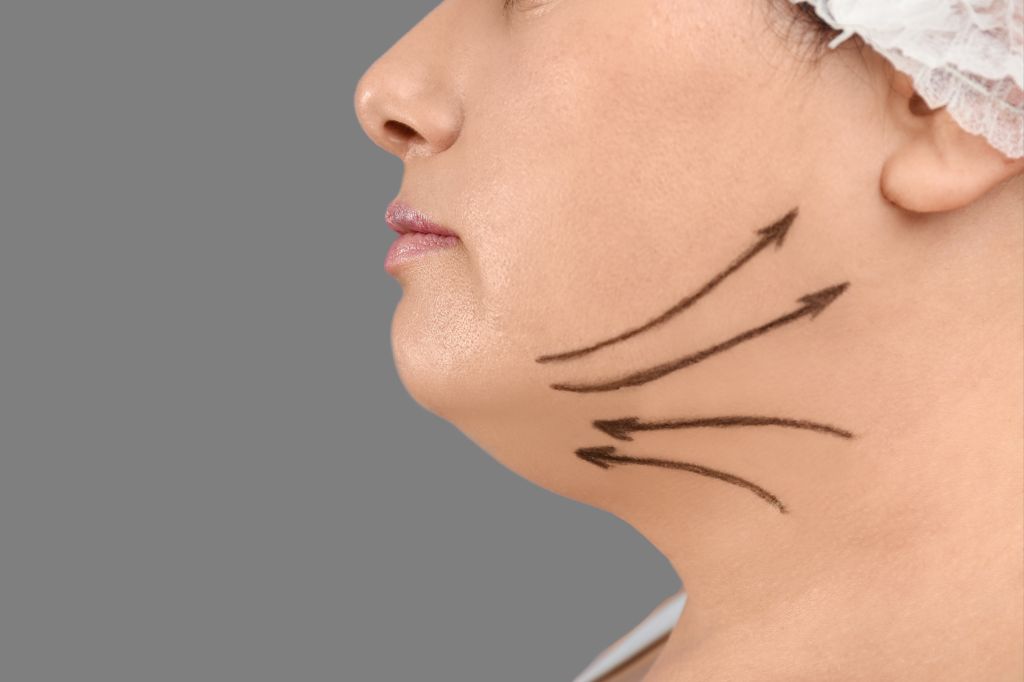 How to Lose Face Fat