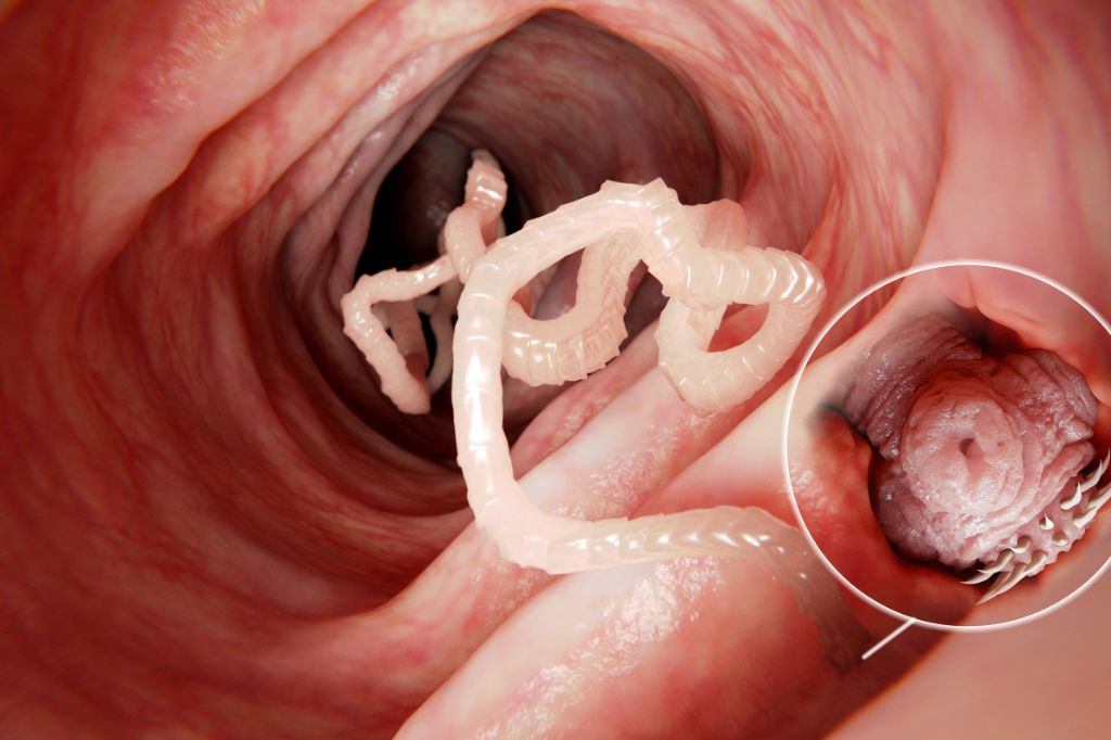 Early Signs of A Tapeworm