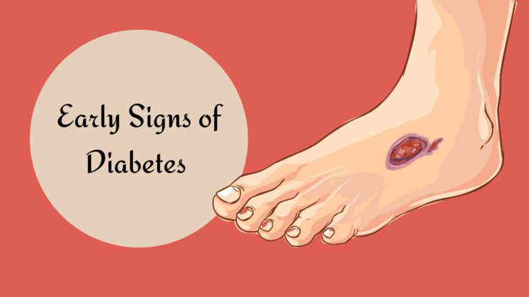 Early Signs of Diabetes