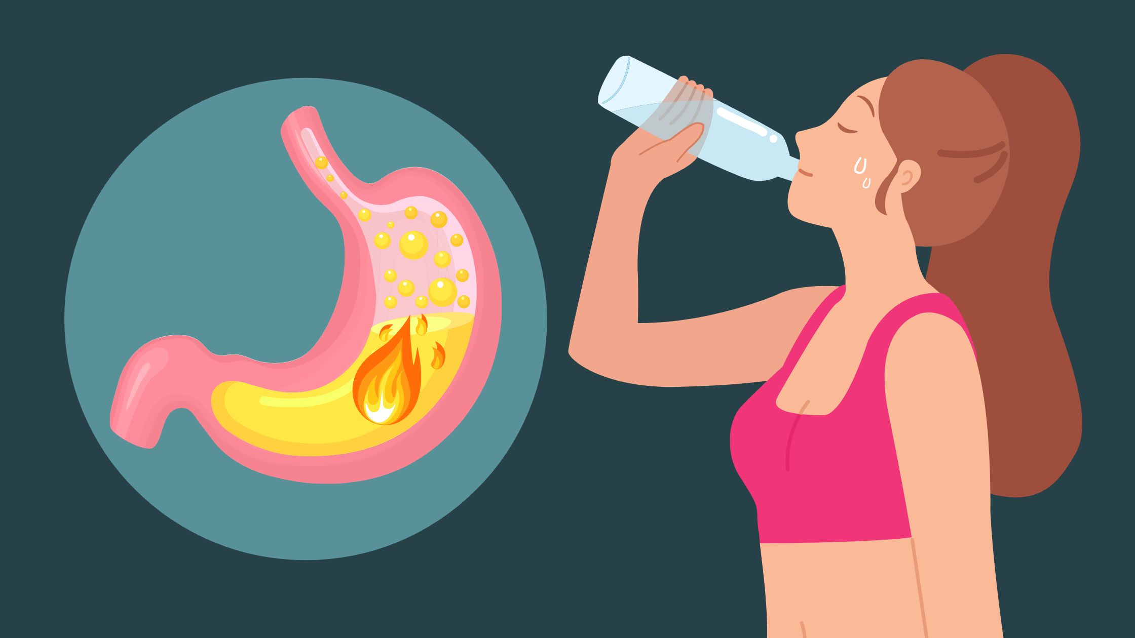 Foods and Drinks That Help with Acid Reflux