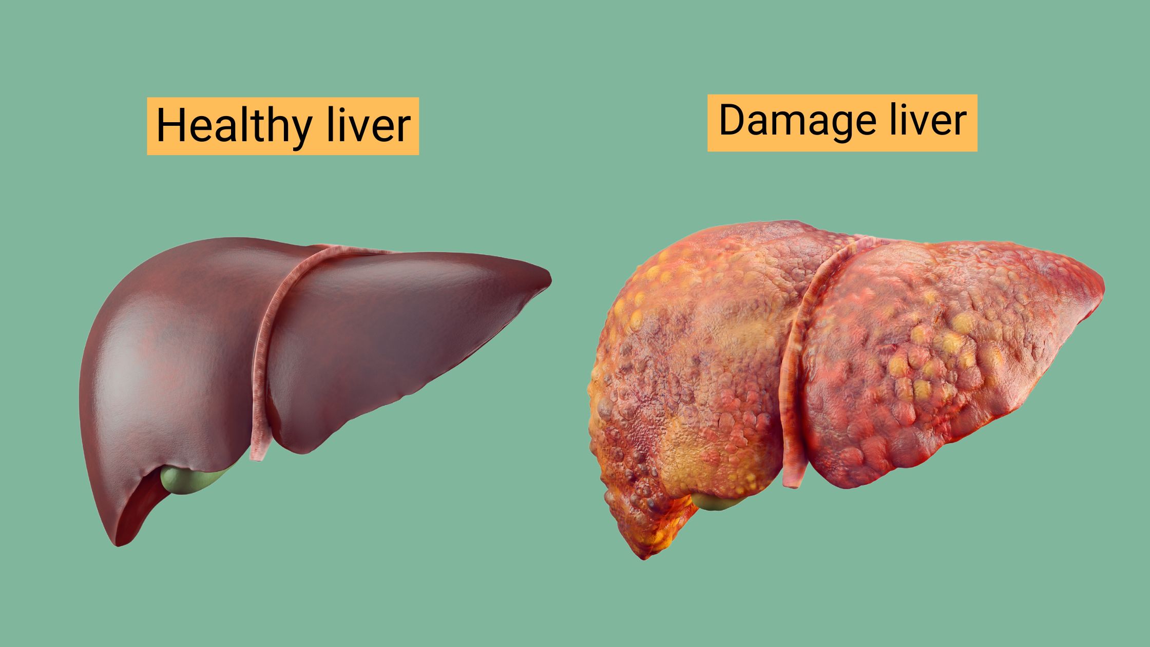 Habits That Can Damage Your Liver