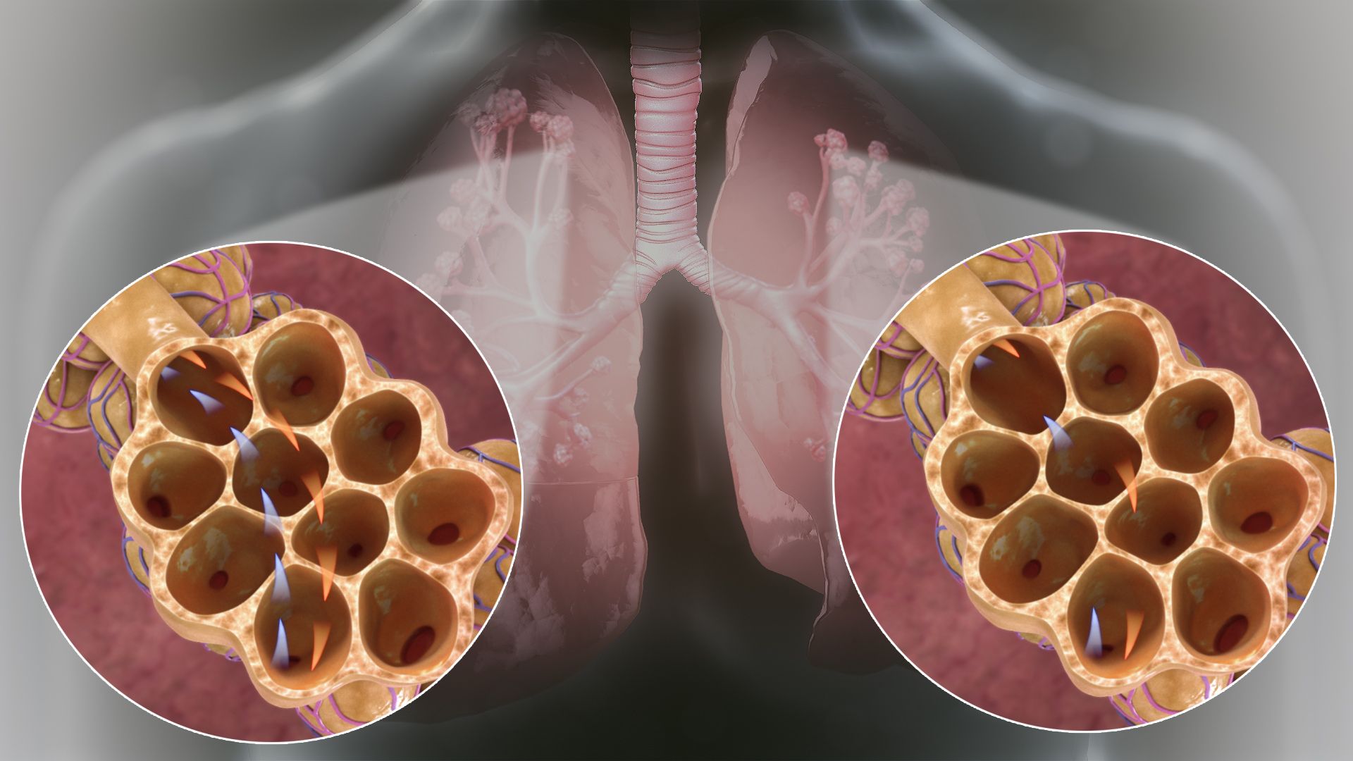 Warning Signs of Lung Disease