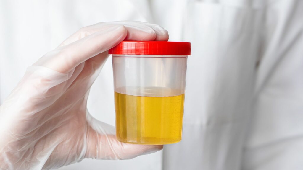 What The Color of Your Pee Says About You