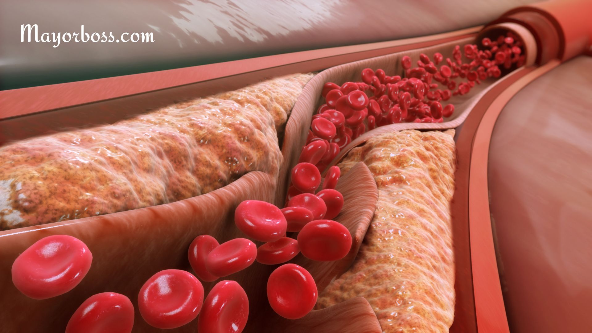 How To Unclog Your Arteries Naturally