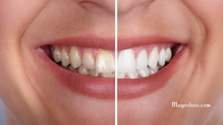 Benefits of Oil Pulling for Dental Health