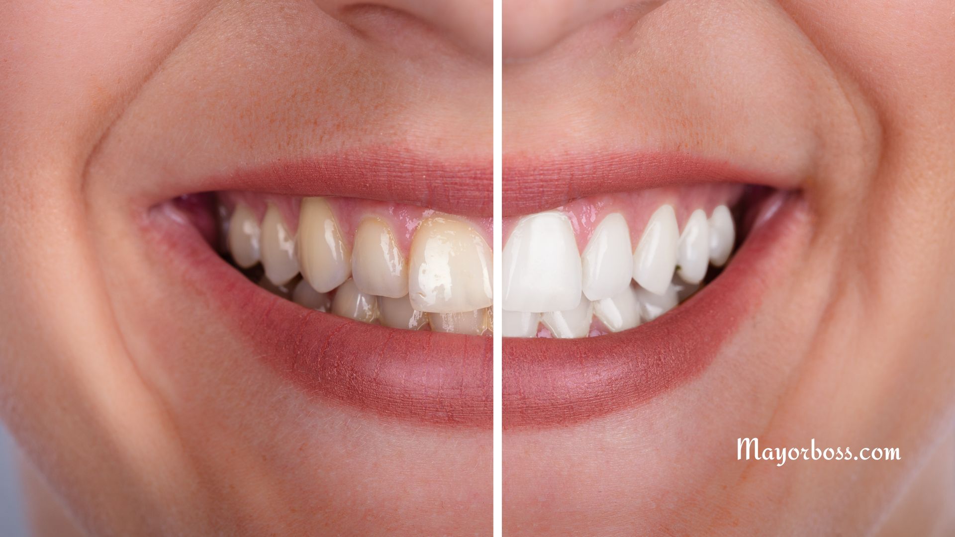 Benefits of Oil Pulling for Dental Health