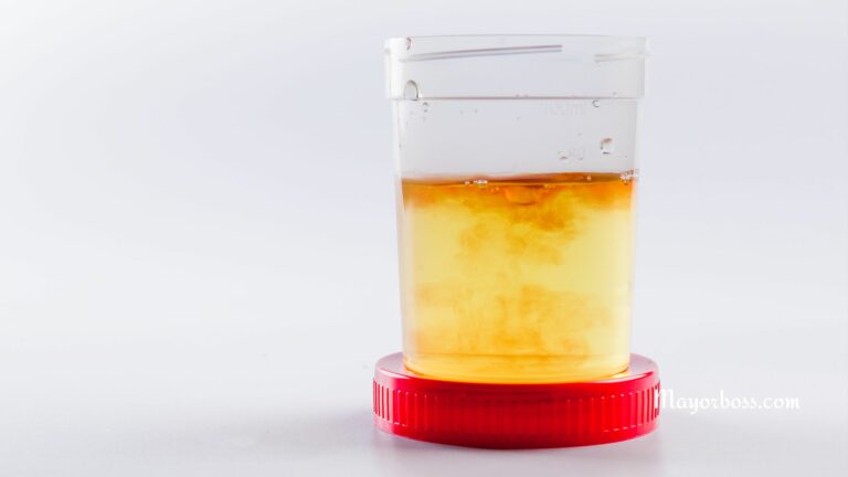 Reasons Why There May Be Blood in Your Urine
