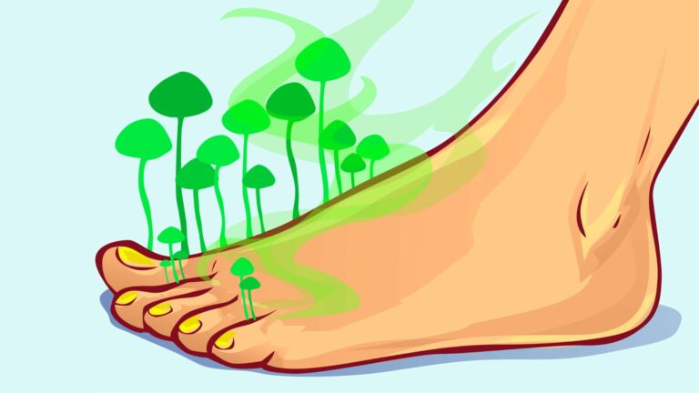 Home Remedies for Foot Odor