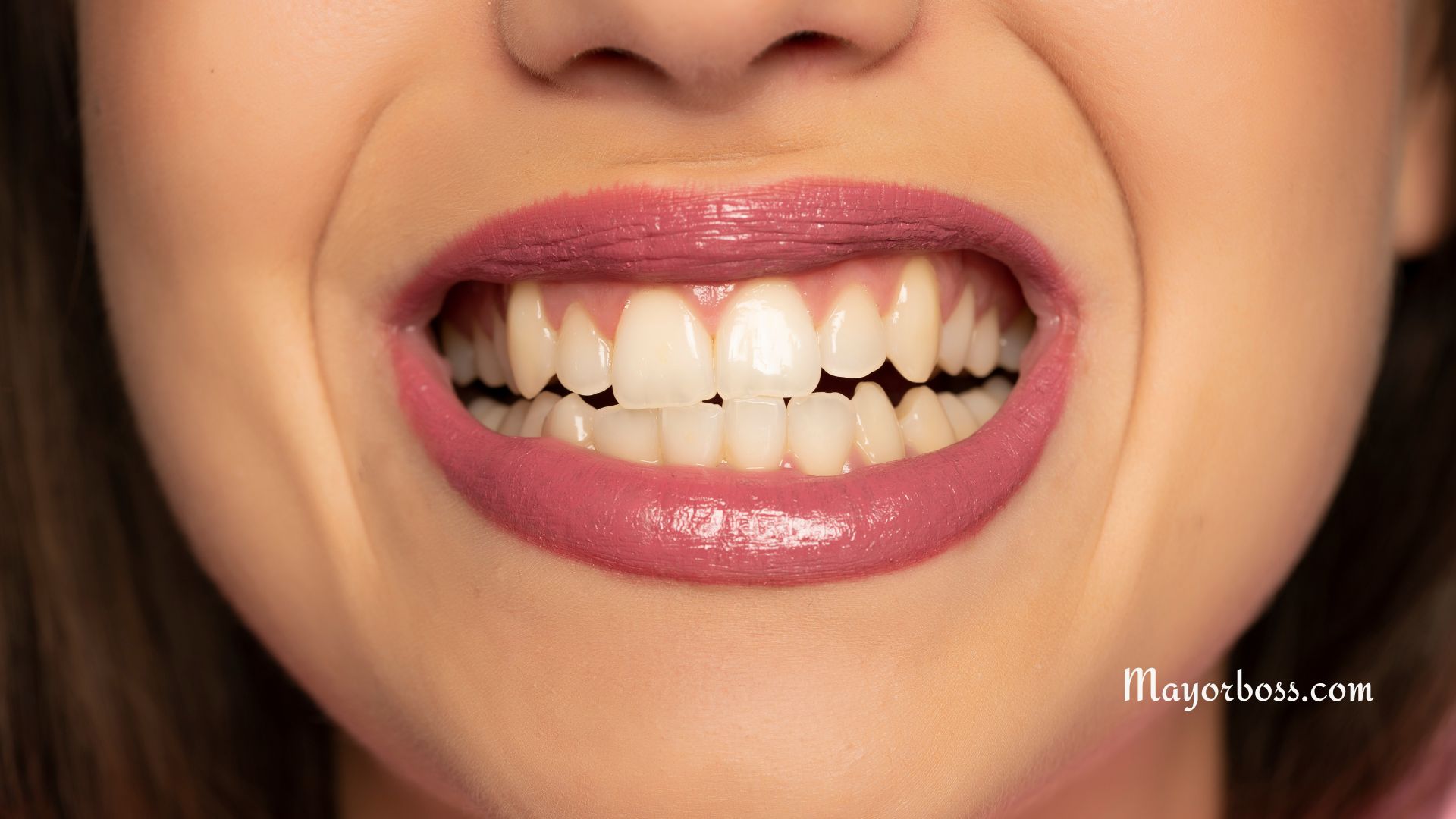 Foods and Drinks That Can Stain Your Teeth