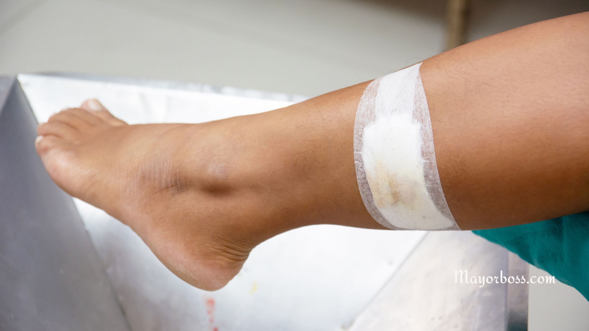 Reasons Why Your Wound Won’t Heal