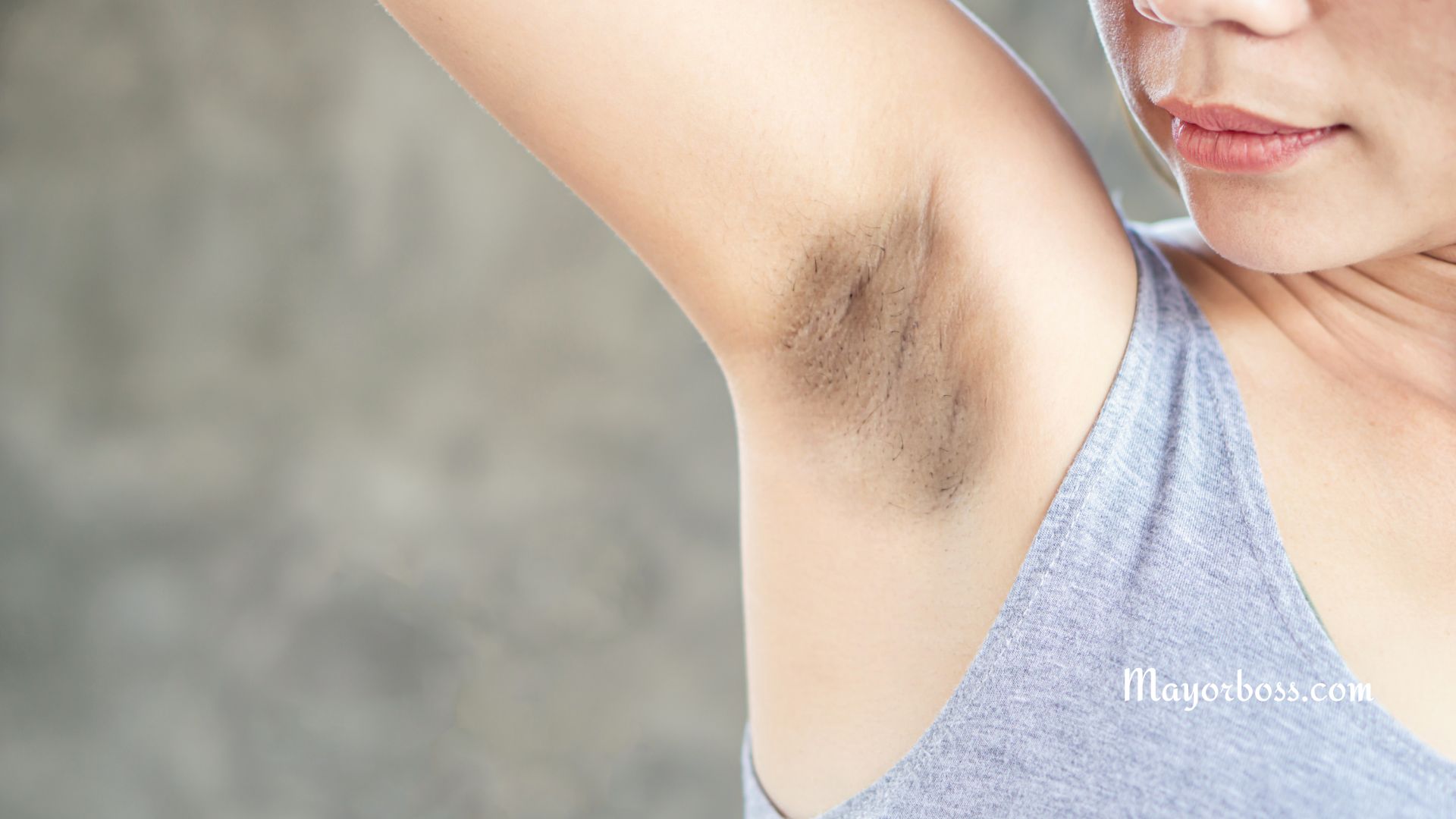 How To Get Rid of Dark Armpits