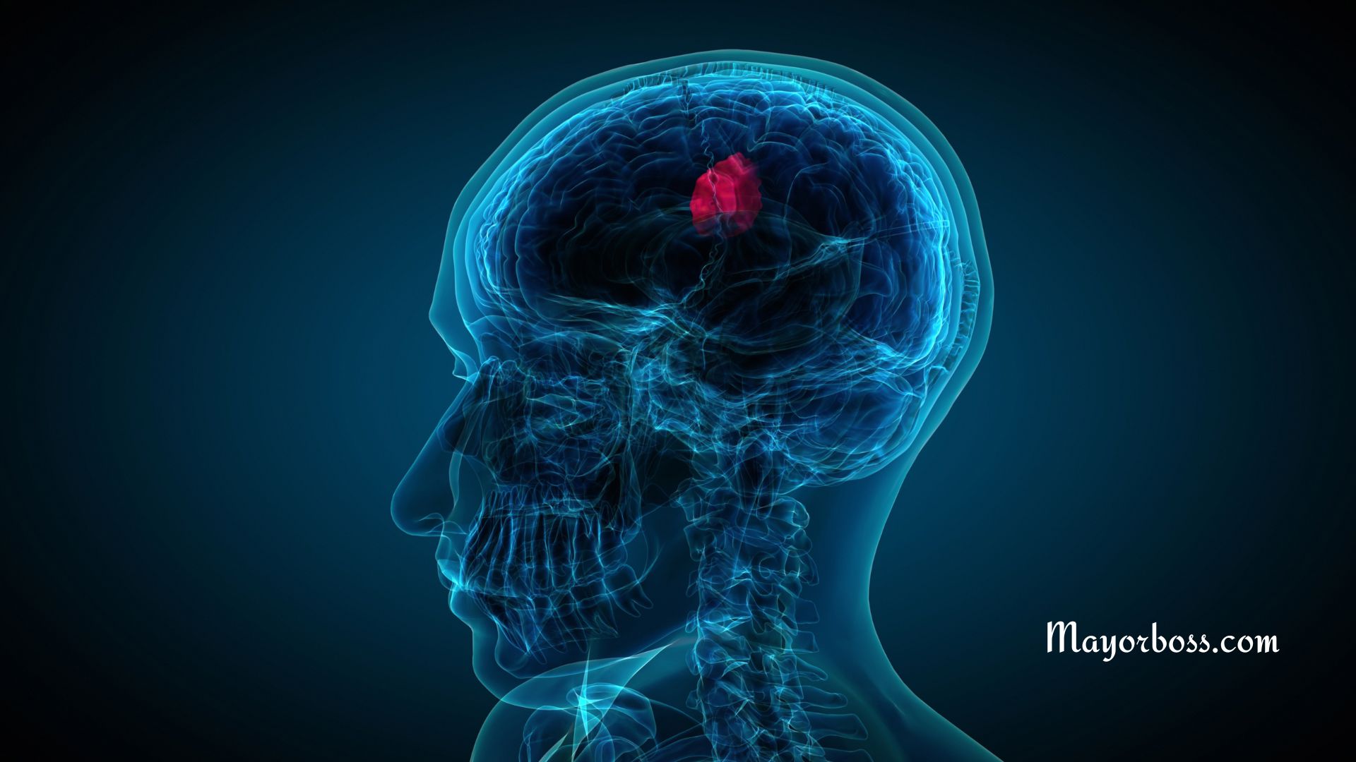 Symptoms Of Brain Tumors