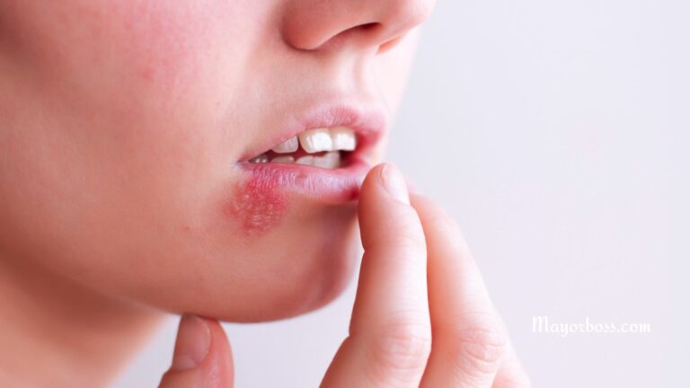 What are Sexually Transmitted Diseases (STDs)