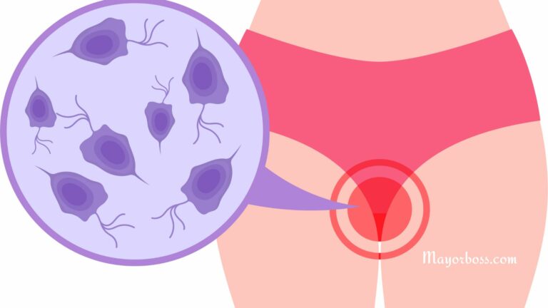 Can a Yeast Infection Cause Bleeding