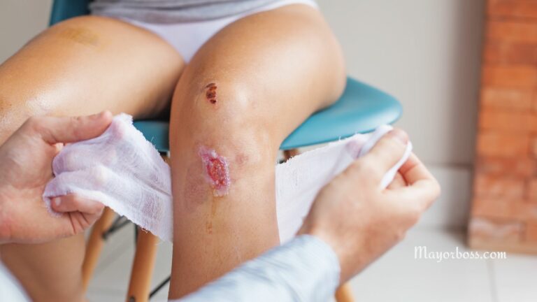 How to Tell if a Wound is Healing or Infected