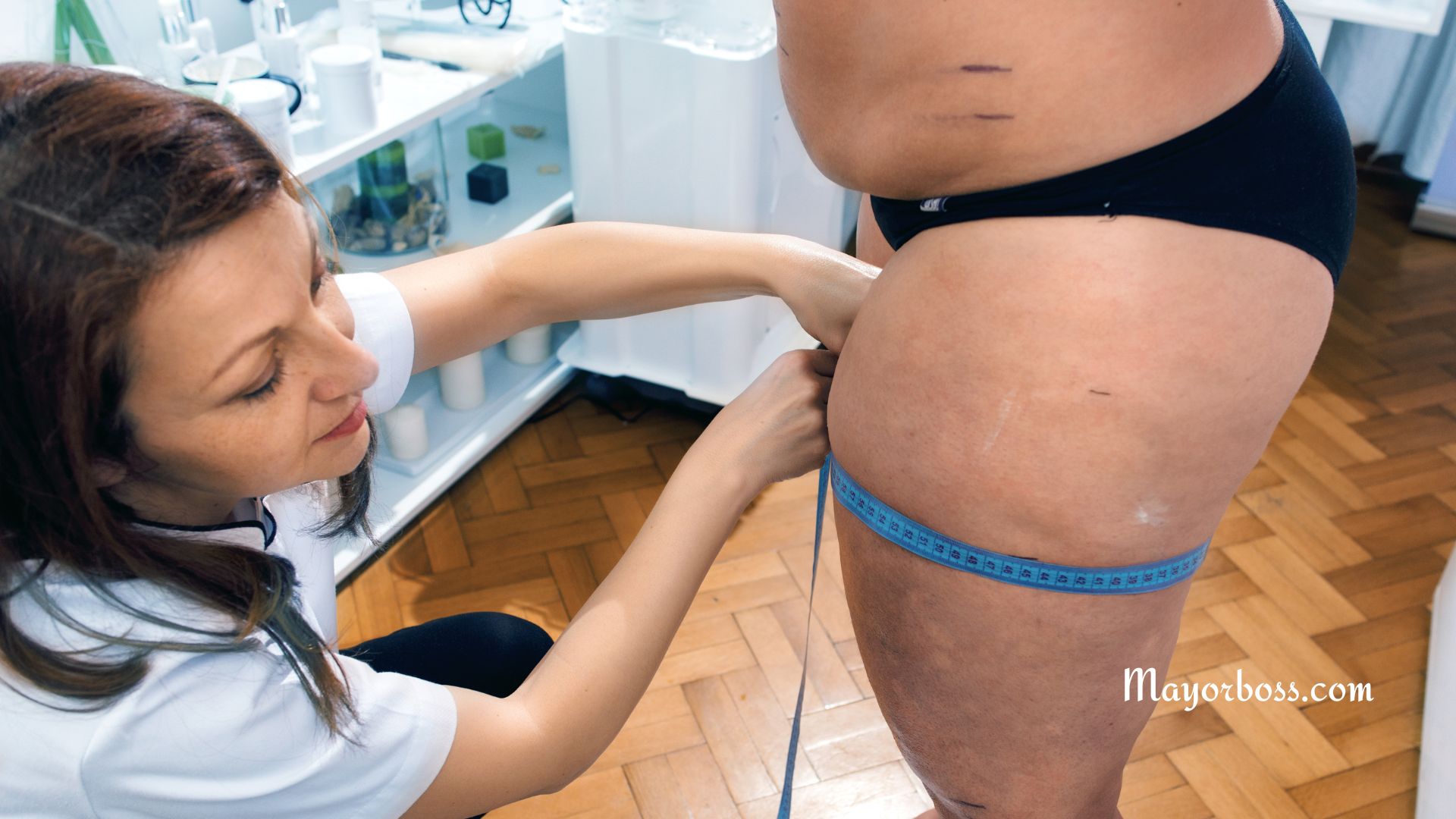 Lipedema: Understanding the Condition and Treatment Options