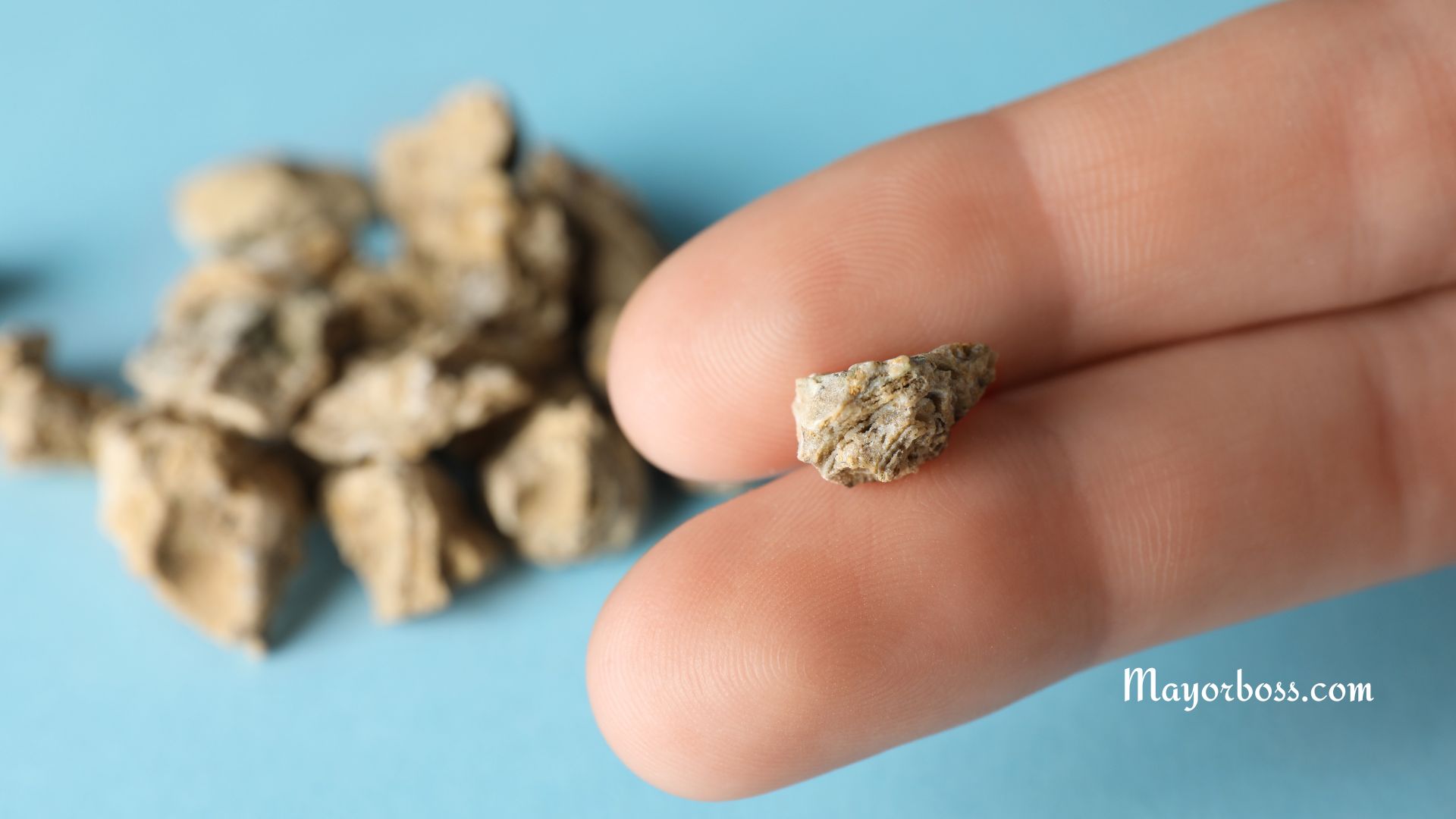 Passed a Kidney Stone in the Toilet? Here's What You Need to Know