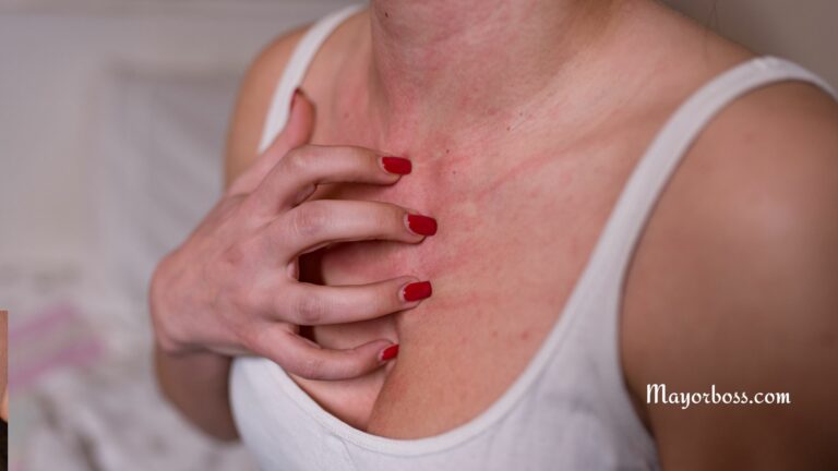 Reasons Your Skin Itches Uncontrollably