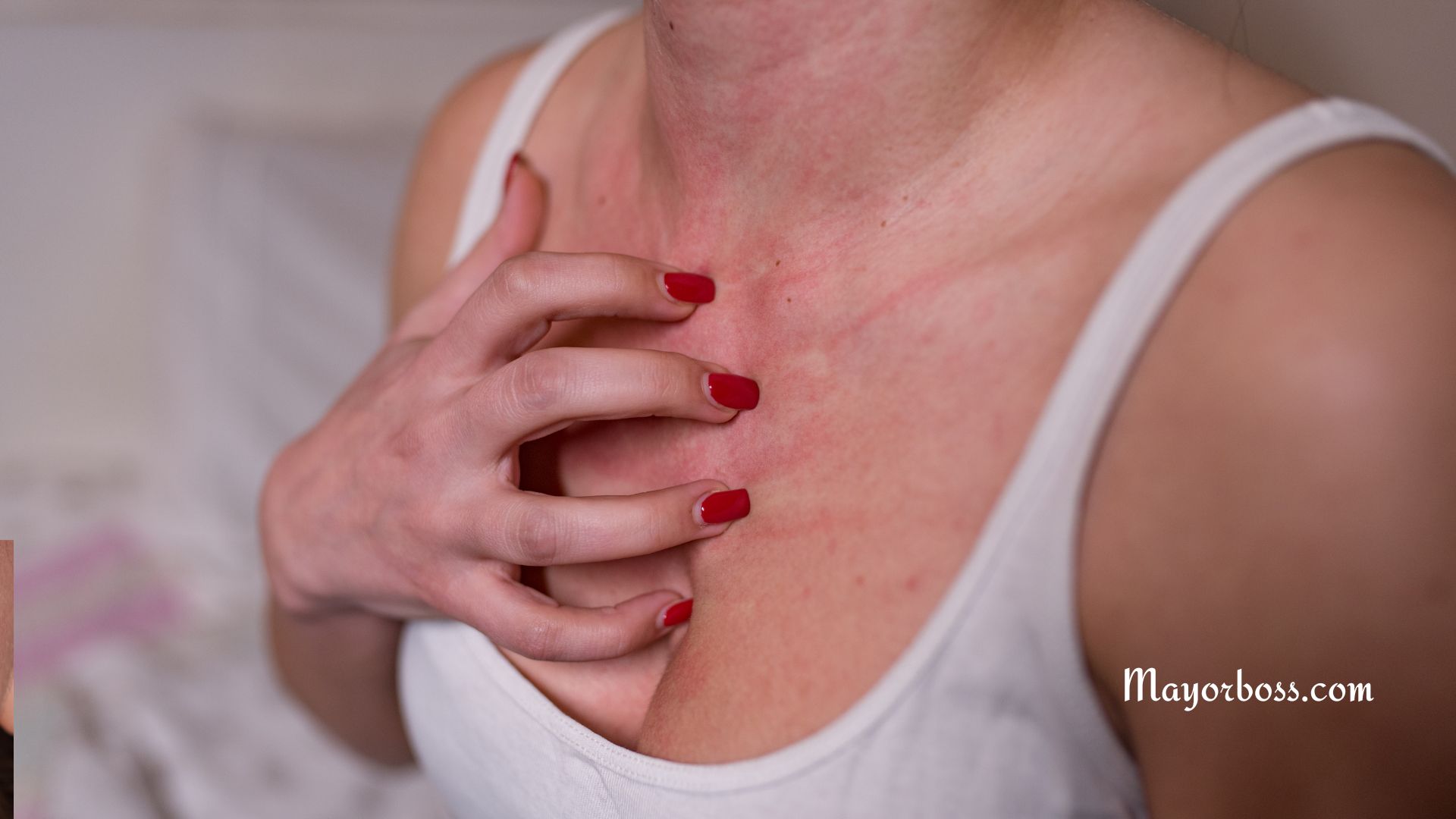 Reasons Your Skin Itches Uncontrollably