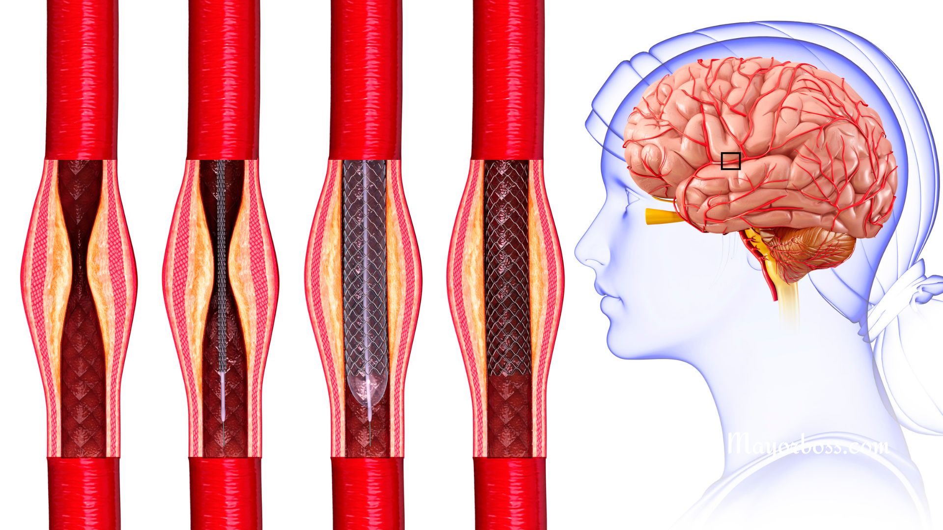 Ways to Increase Cerebral Blood Flow Naturally