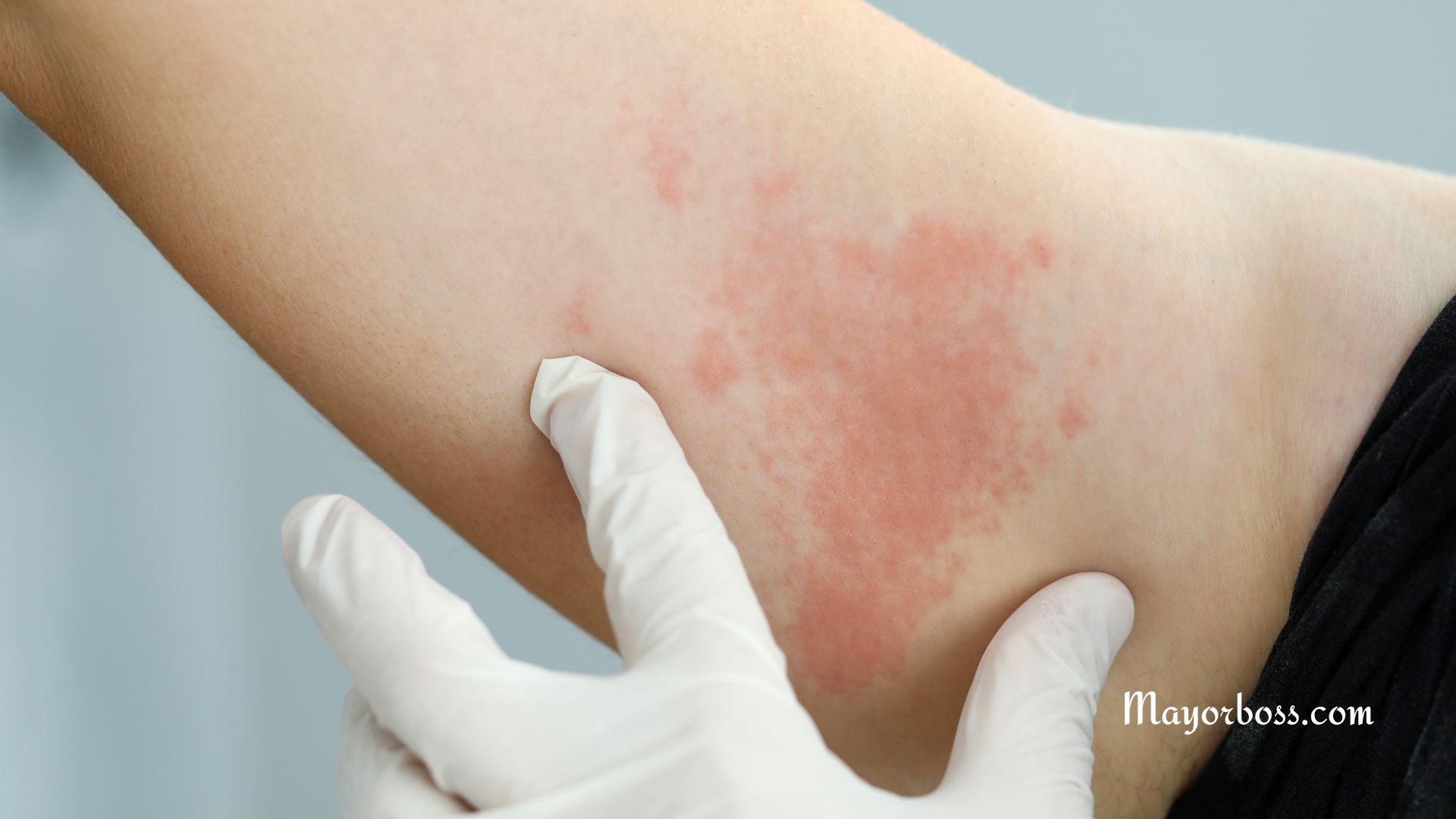 Histamine
