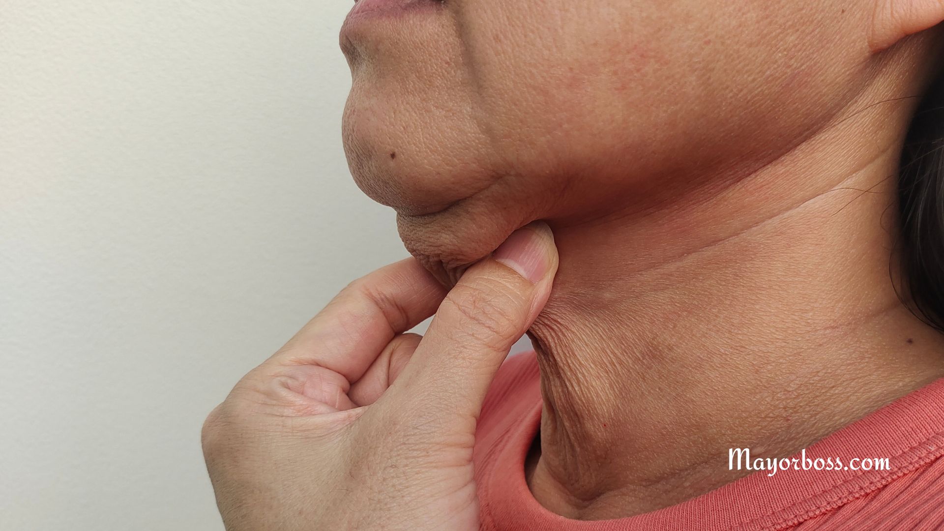 How to Get Rid of Neck Fat